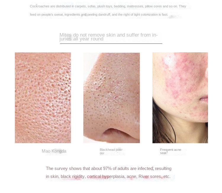 Korean Gold Mite Soap