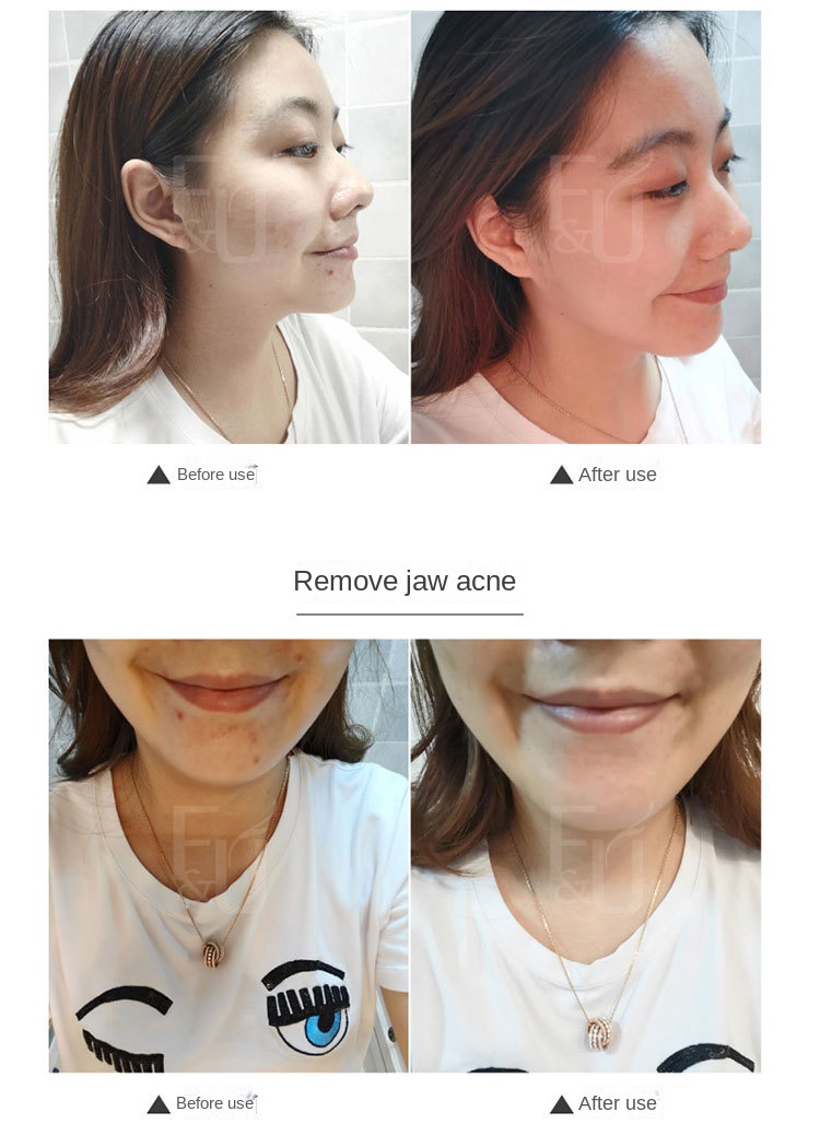 Korean Gold Mite Soap