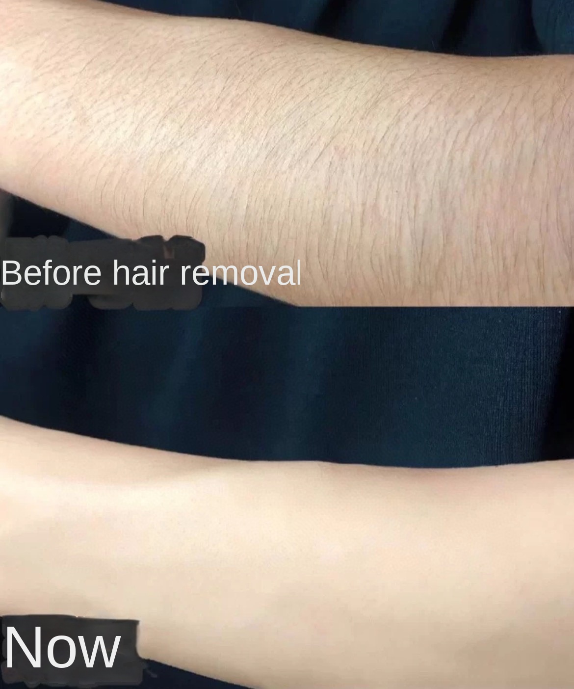 Gentle Foam Hair Removal Spray