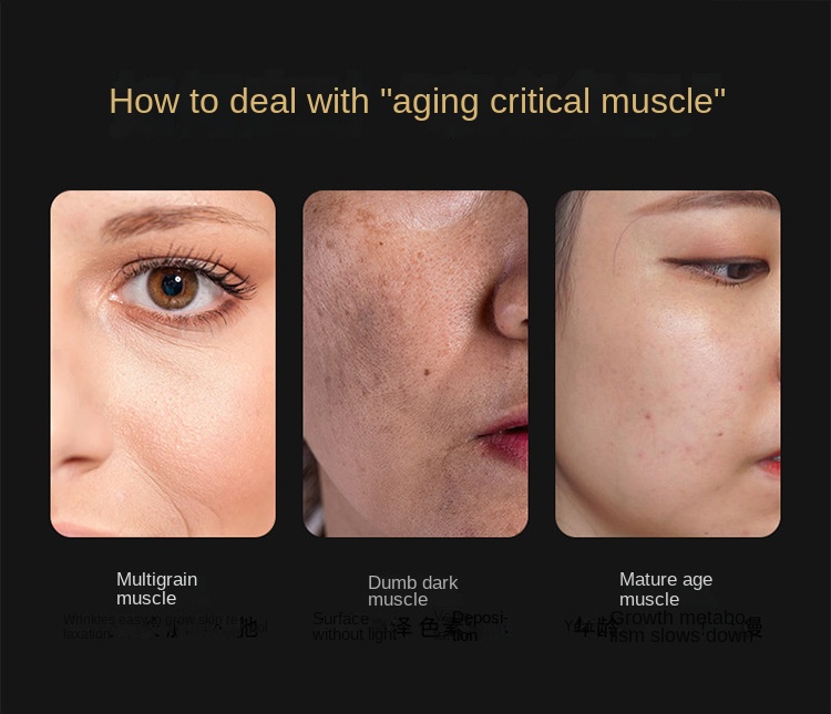 Korean Black Band Eye Cream