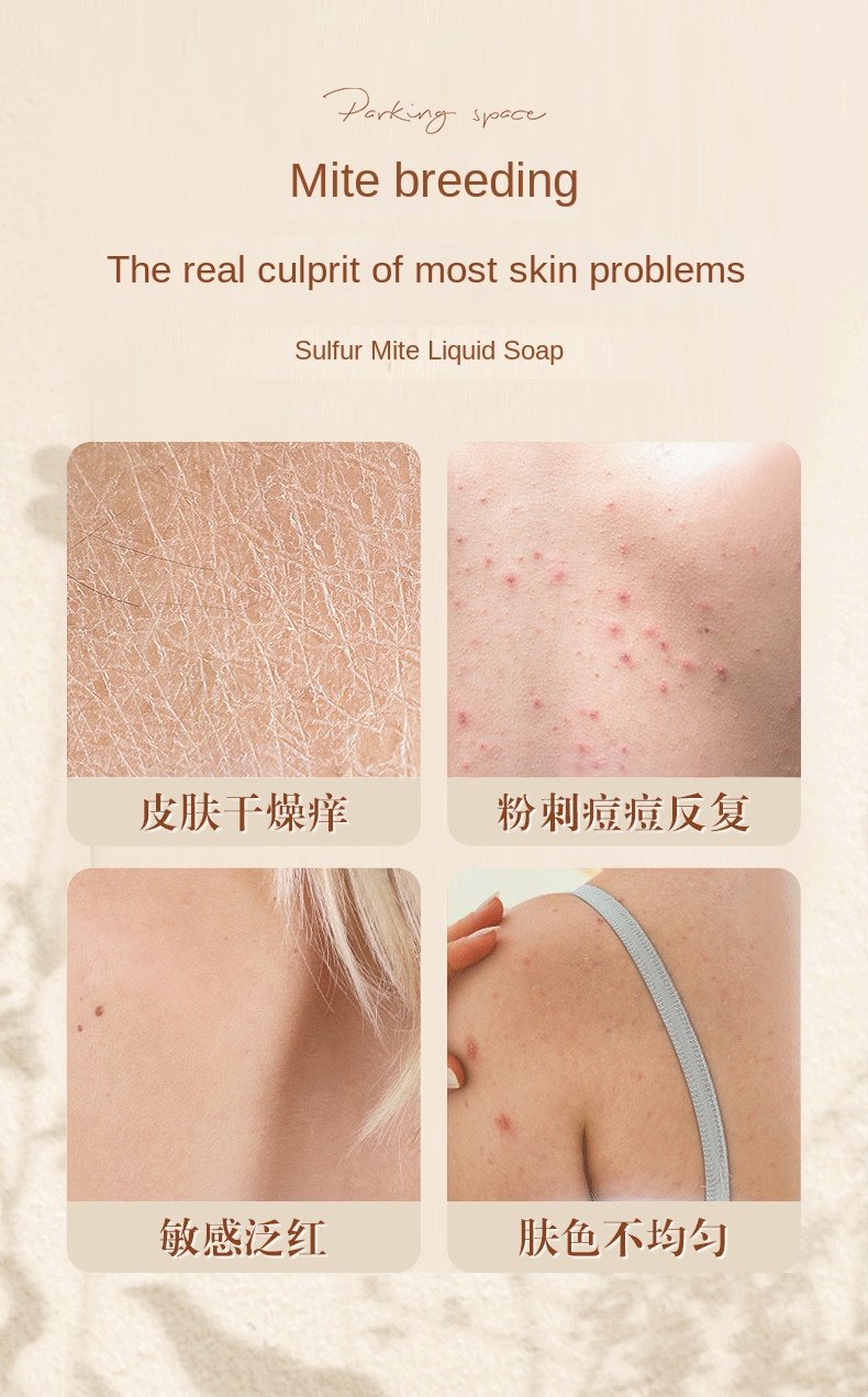 Sulfur Control Moisturizing Mite Removal Gentle Shower Gel