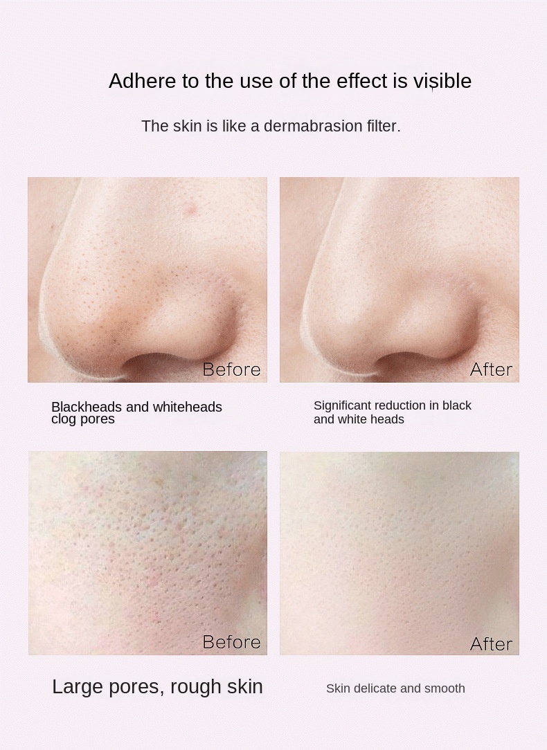 Pore Cleansing Mud Mask