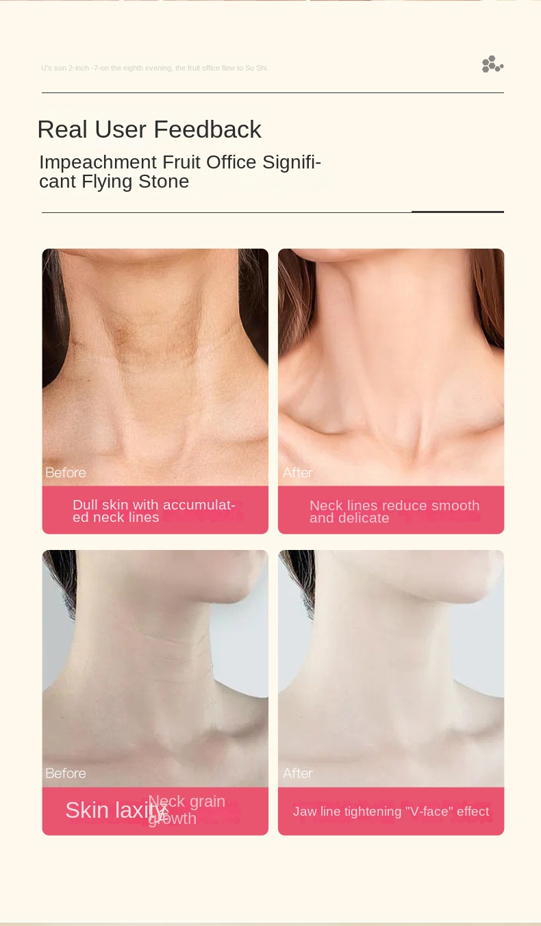 Snow Delight Honey Neck Cream with Dual Rollers for Neck Line Smoothing and Firming